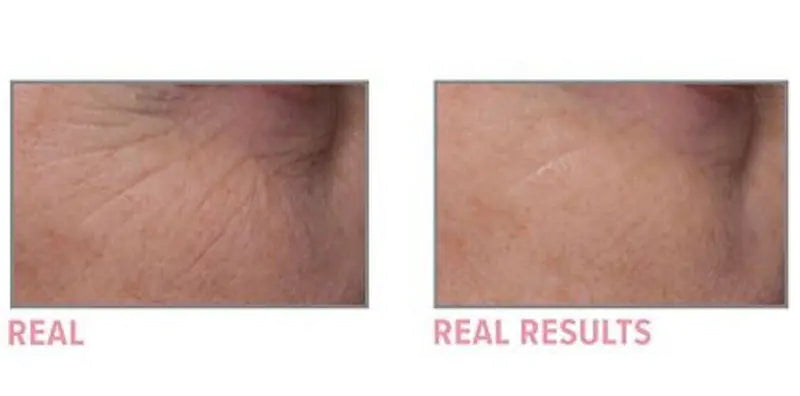 Super Moisturizing Anti-Wrinkle Cream